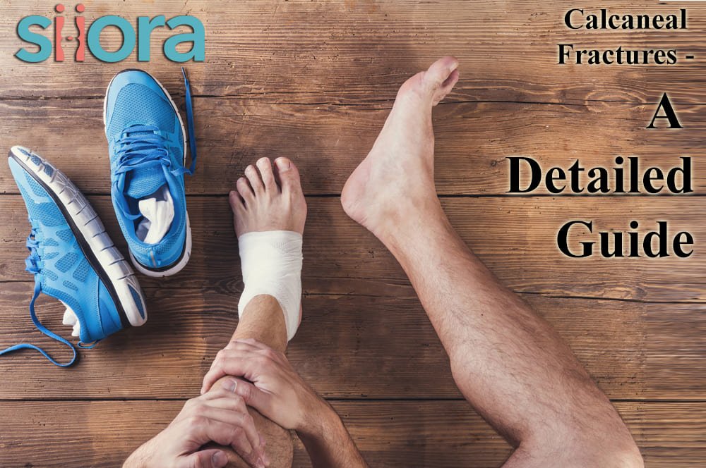 Calcaneal Fractures - A Detailed Guide