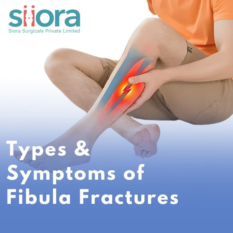 Types & Symptoms of Fibula Fractures