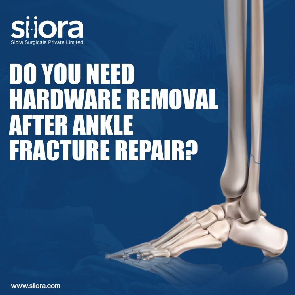 Hardware Removal - Ankle Fracture