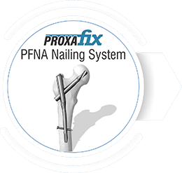PROXAFIX PFNA Nailing System