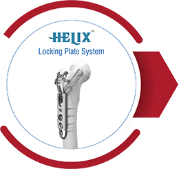 TRIFIX Supra Condylar Nailing System