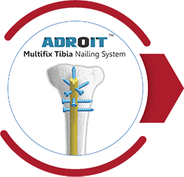 ADROIT Multifix Tibia Nailing System