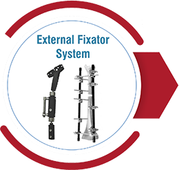 External Fixator System