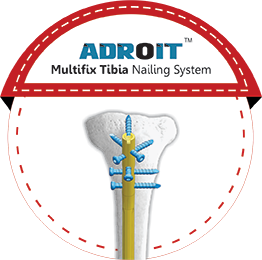 ADROIT Multifix Tibia Nailing System