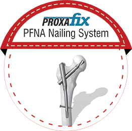 PROXAFIX PFNA Nailing System