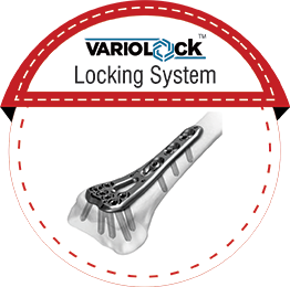 VARIOLOCK Locking System