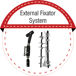 External Fixator System