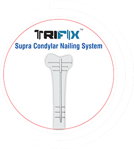 TRIFIX Supra Condylar Nailing System