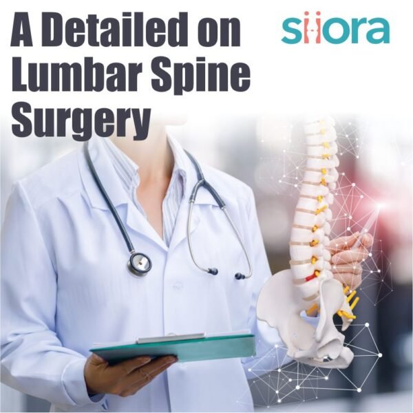 Lumbar Spine Surgery - A Detailed Guide