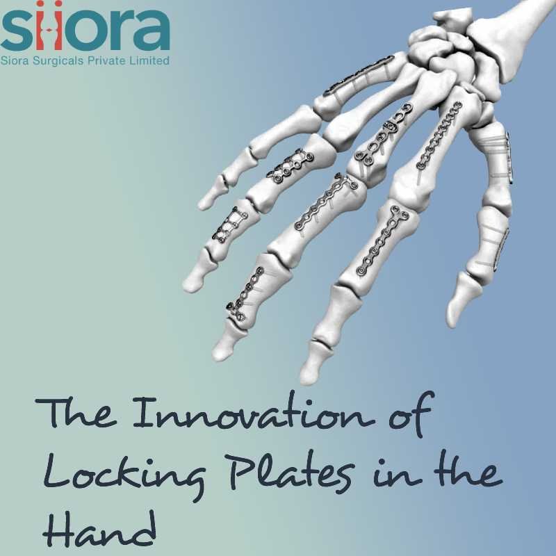 Read more about the article The Innovation of Locking Plates in the Hand