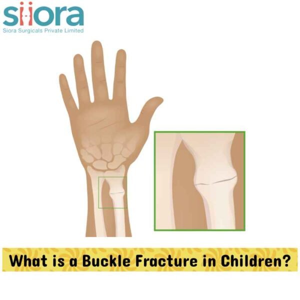 Buckle Fractures in Children A Detailed Guide