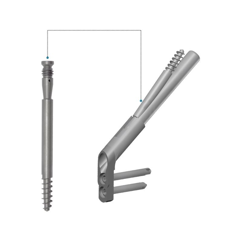 FNS – Antirotation Leg Screw – Titanium