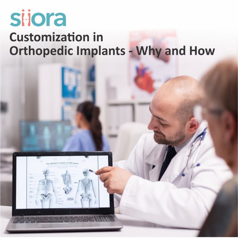 Customization in Orthopedic Implants – Why and How