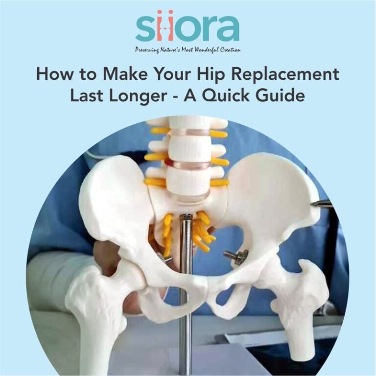 How to Make Your Hip Replacement Last Longer - A Quick Guide - Siora ...