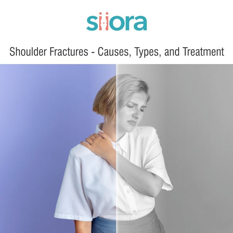 Shoulder Fractures - Causes, Types, and Treatment