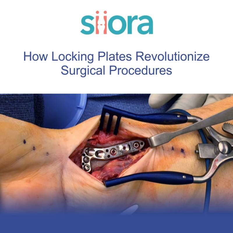 How Locking Plates Revolutionize Surgical Procedures