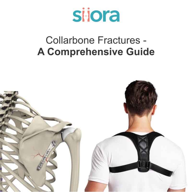 Collarbone Fractures