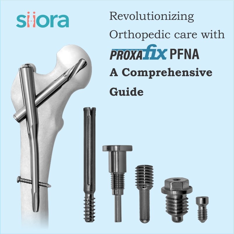 Revolutionizing Orthopedic Care with Proxafix PFNA Implants: A Comprehensive Guide