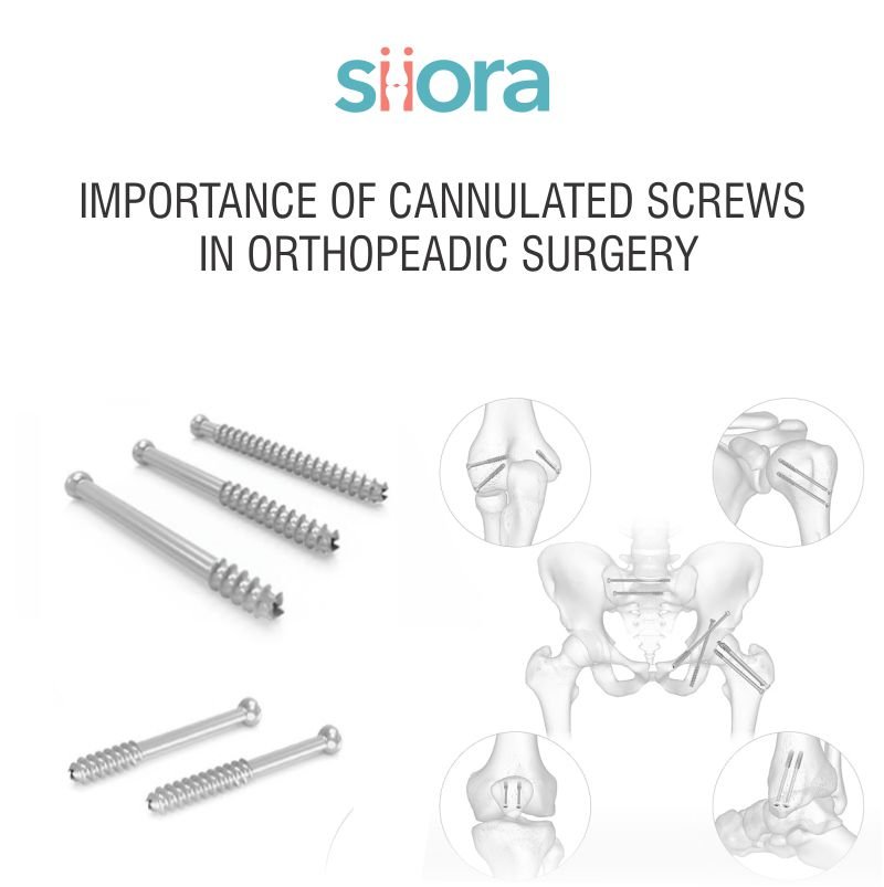 Importance of Cannulated Screws