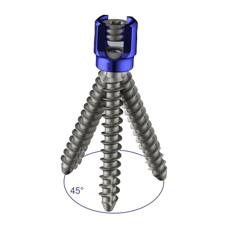 Polyaxial R-Line Pedicle Screw - Siora Surgicals Private Limited