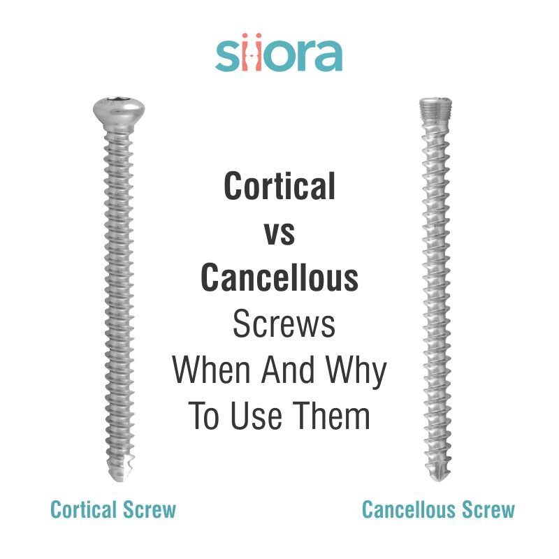 Cortical and Cancellous Screws