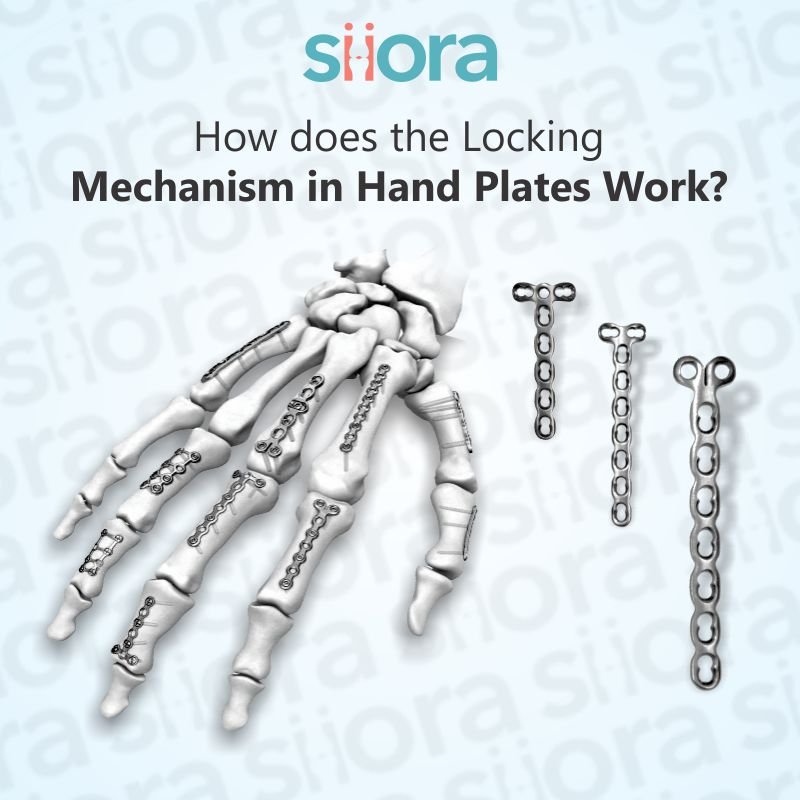 How Does the Locking Mechanism in Hand Plates Work