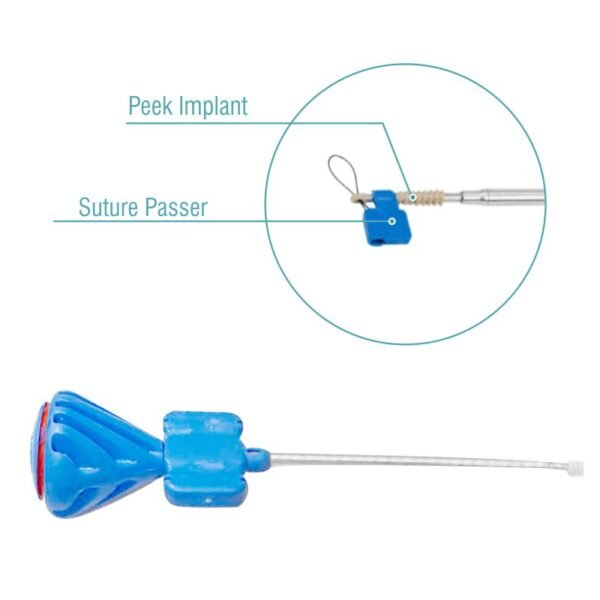 KNOTLESS Peek Screw in Suture Anchor with Peek Tip - Sterile