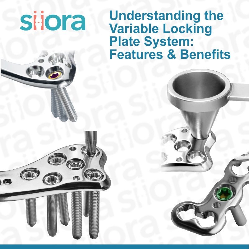 Read more about the article Understanding the Variable Locking Plate System: Features & Benefits