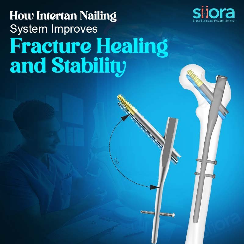 How Intertan Nailing System Improves Fracture Healing and Stability