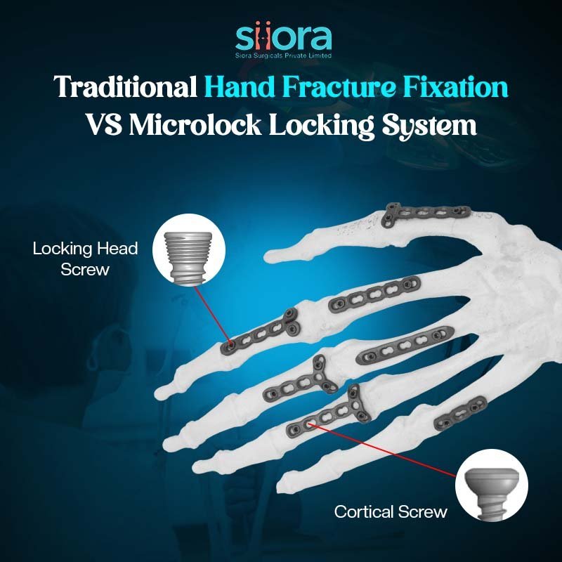 Locking screw and cortical screw
