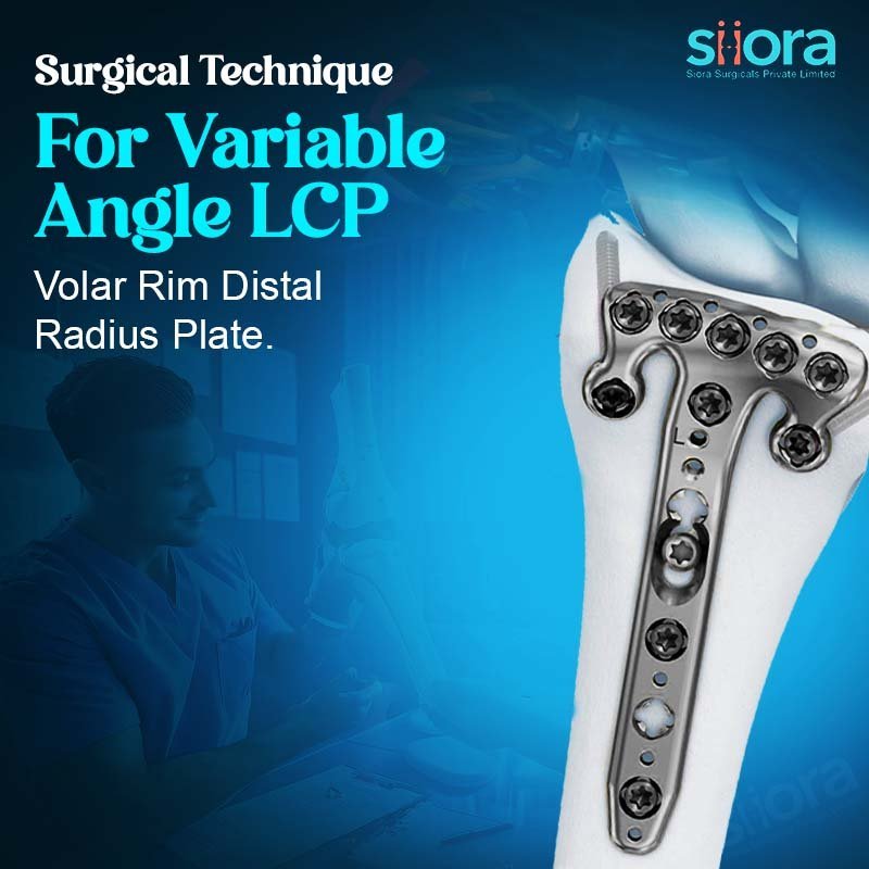 Surgical Technique for Variable Angle LCP (Volar Rim Distal Radius Plate 2.4)