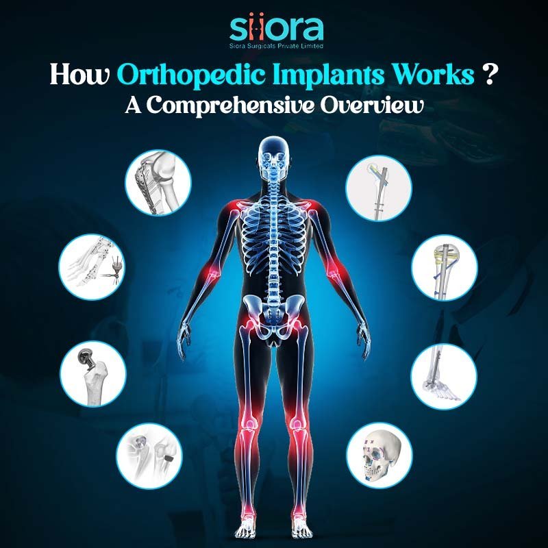 how orthopedic implants work
