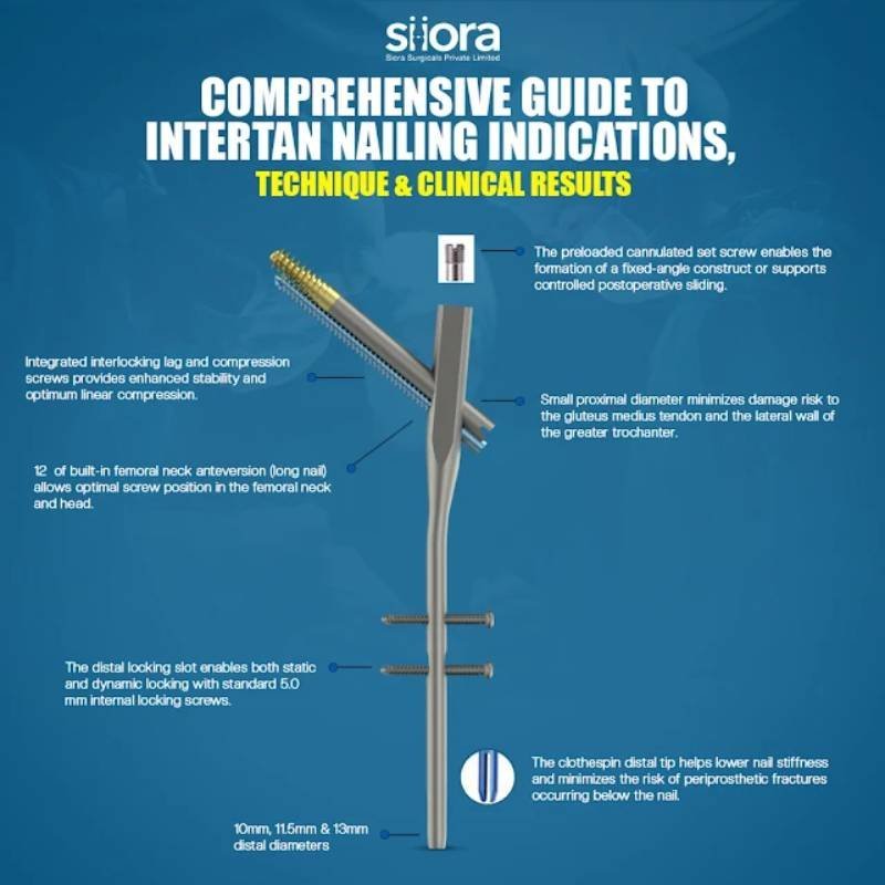 comprehensive guide to intertan nailing indications