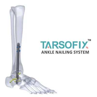 tarsofix logo