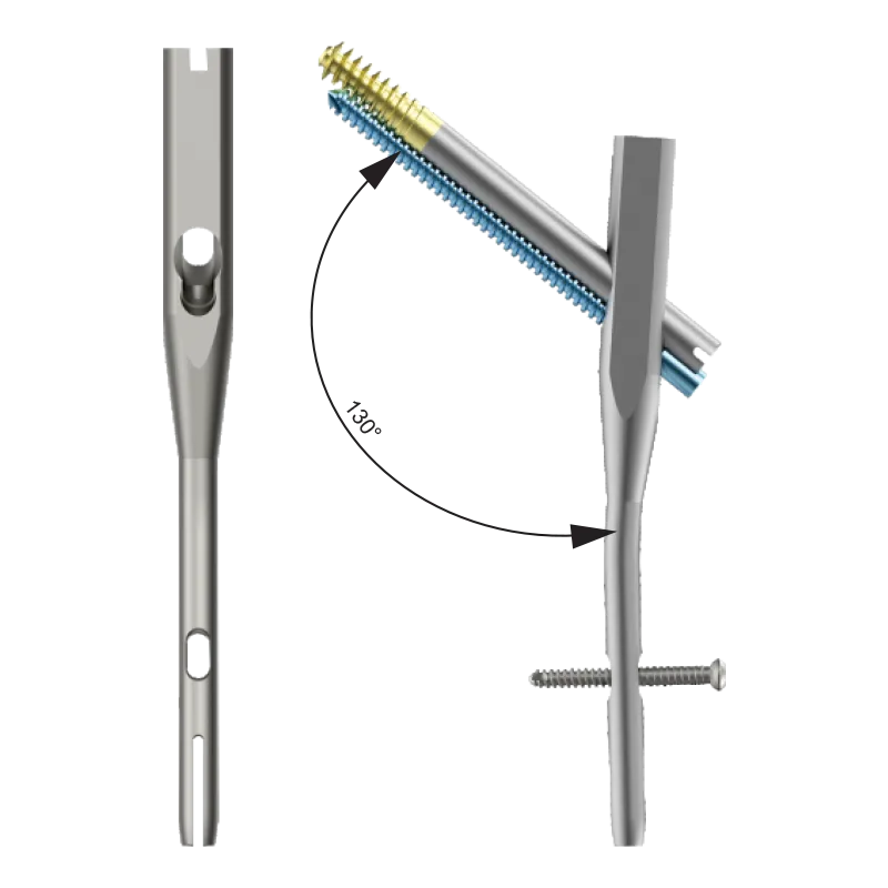 DUROFIX™ Intertan Nail – Short 130 Deg.- Titanium