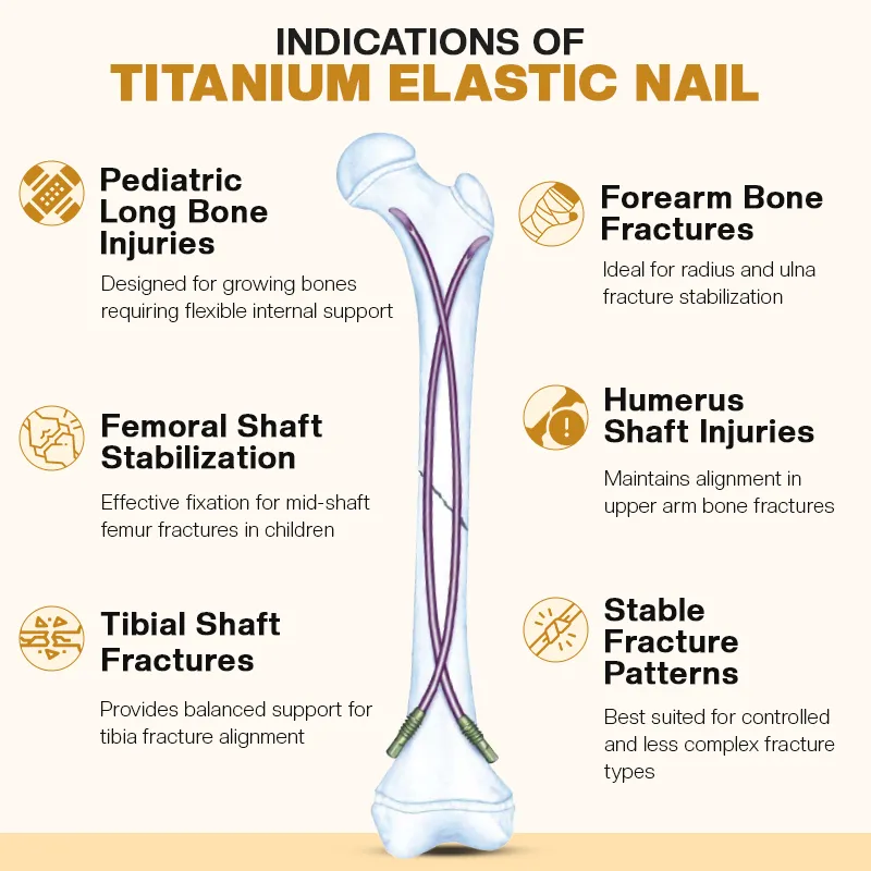 Indications of Titanium Elastic Nail