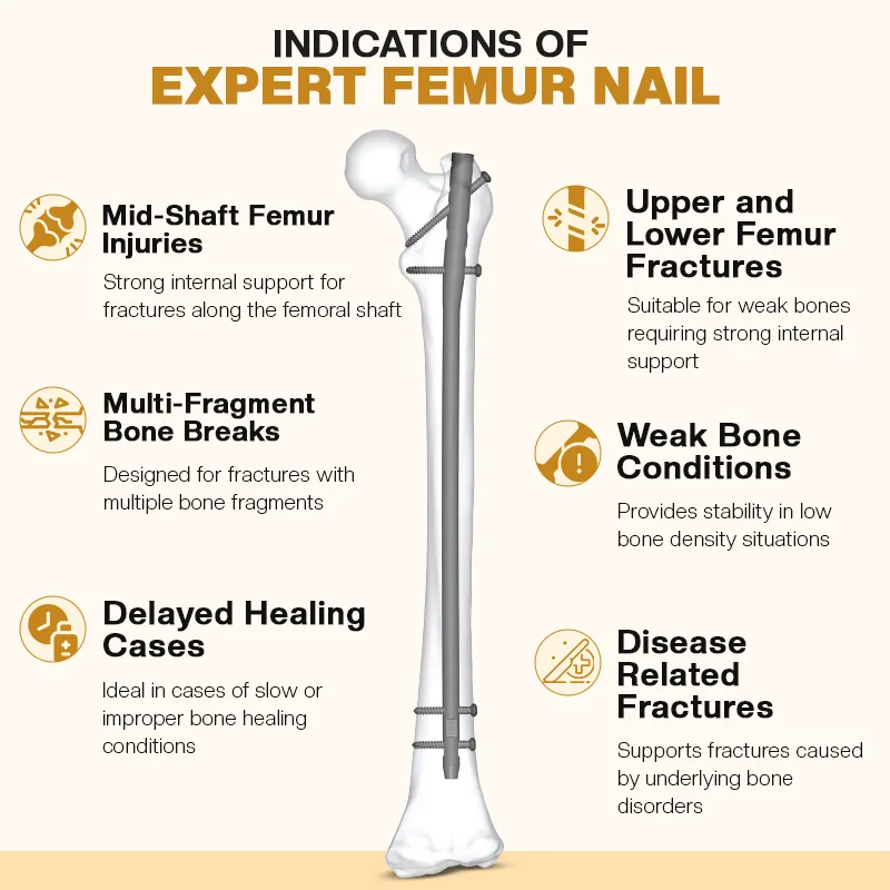 Indications of Expert Femur Nail