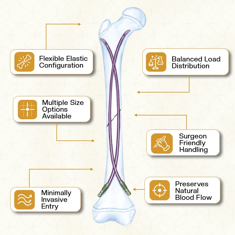 Key feature of Titanium Elastic Nail