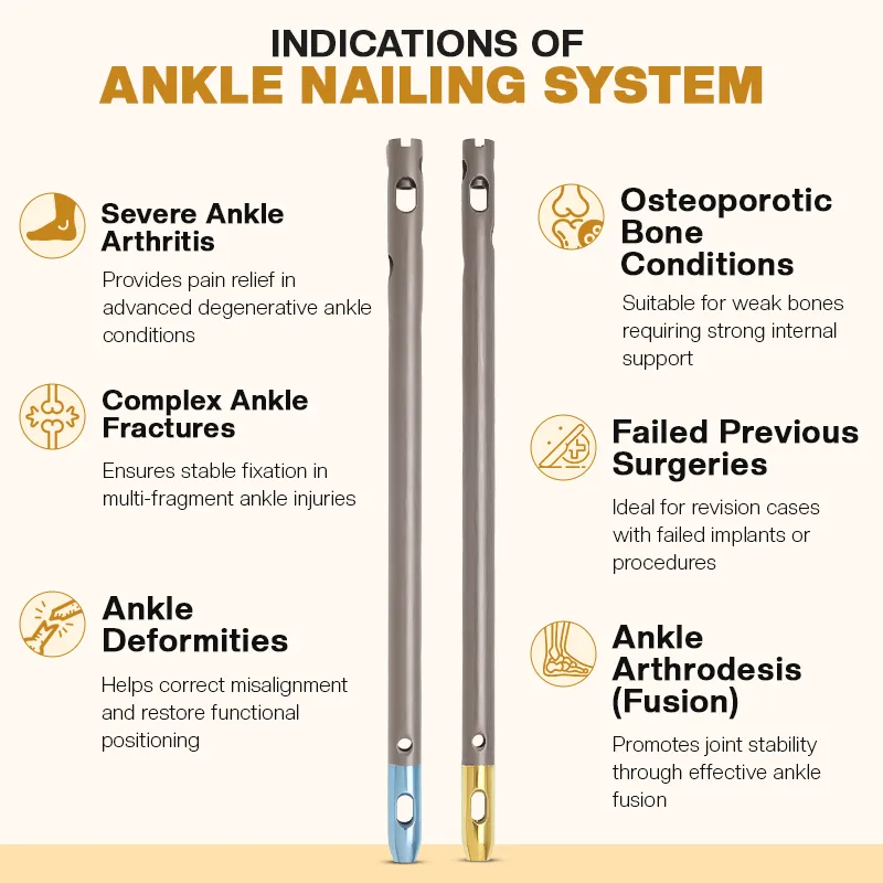 Indications of the Ankle Nailing System