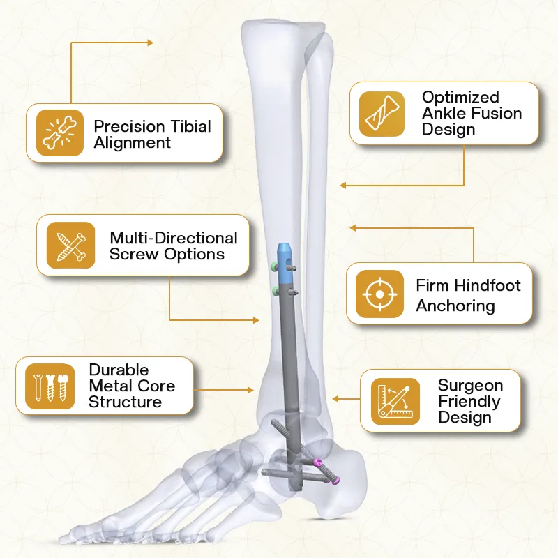 Key feature of Ankle Nailing System