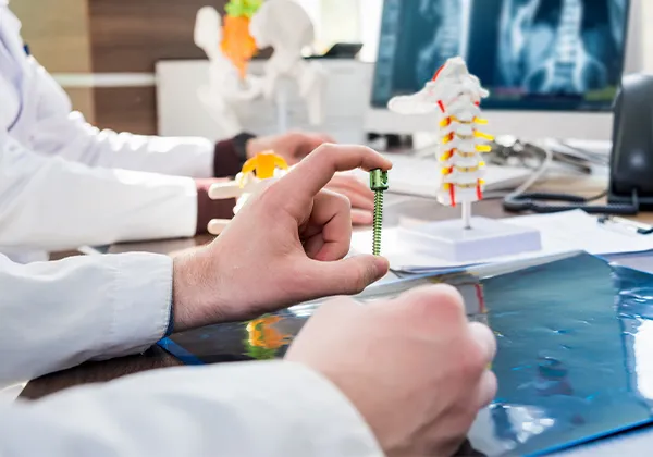 Why Choose Siora’s Spine Implant Solutions