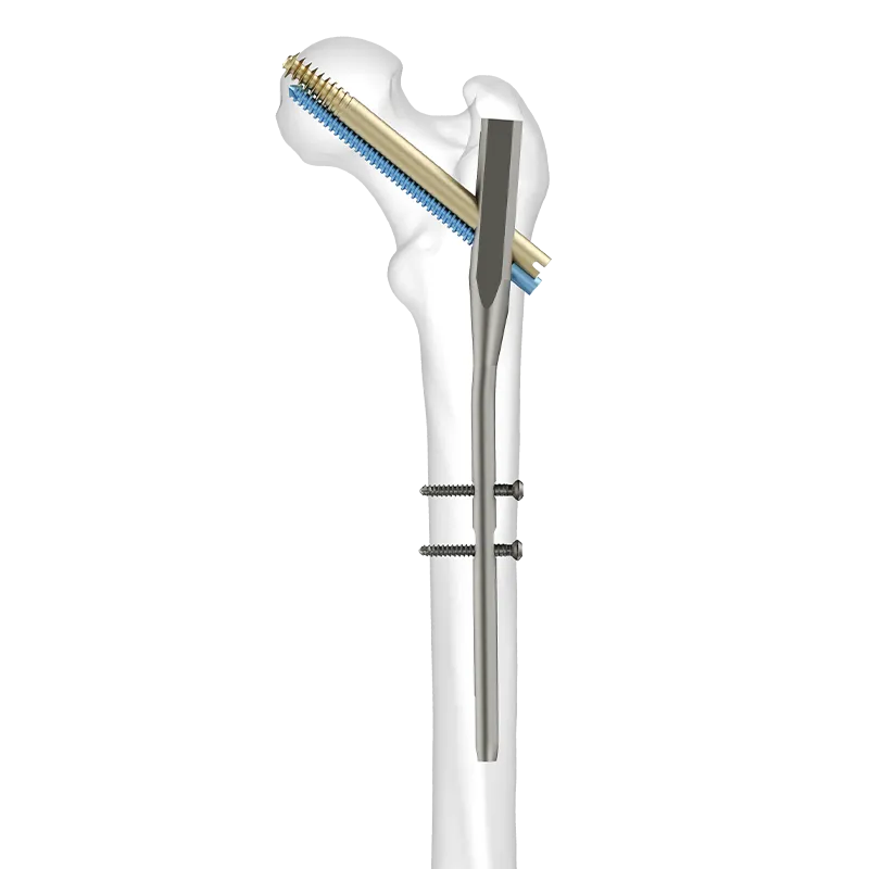 Durofix™ Intertan Nailing System