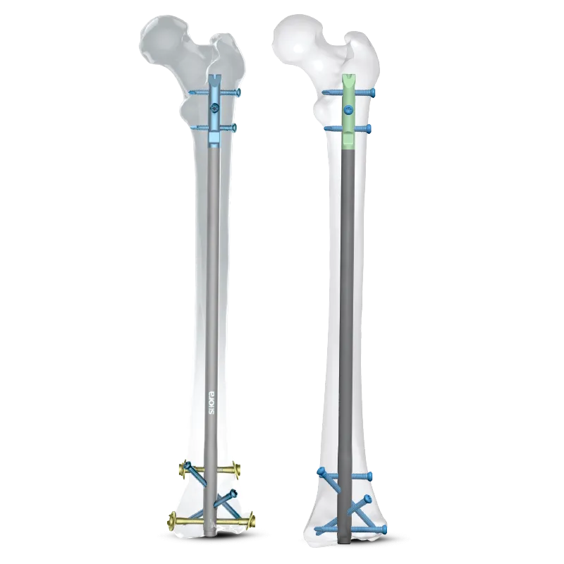 rigifix implant with bone