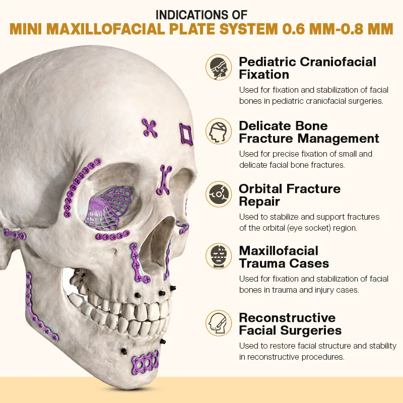 Indications of Mini Maxillofacial Plate System 0.6mm - 0.8mm