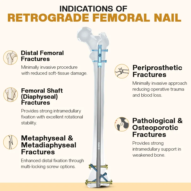 Indications of Retrograde Femoral