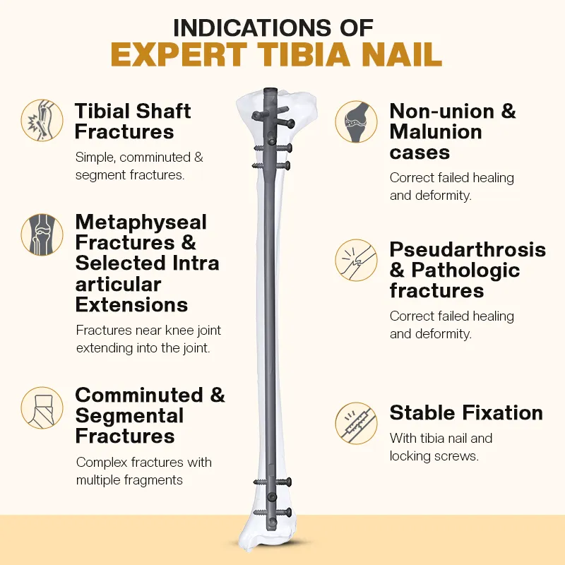 Indications of Expert Tibia Nail