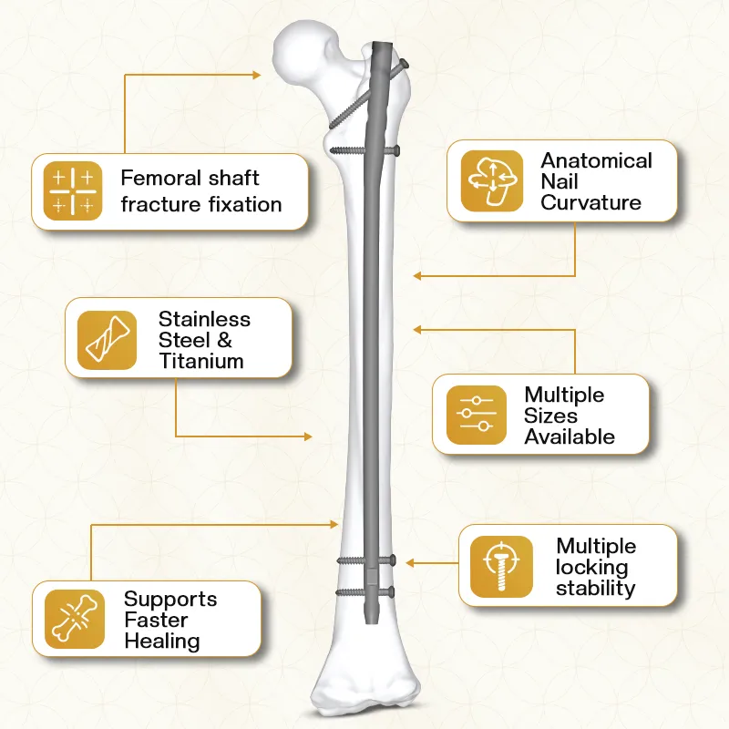 Key Features of Expert Femur Nail