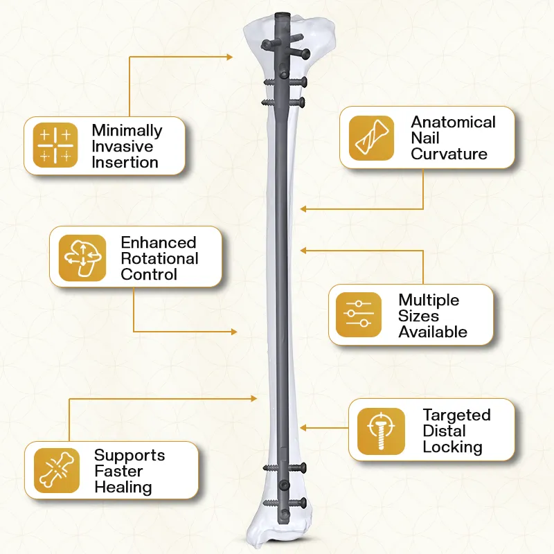 Key Features of Expert Tibia Nail