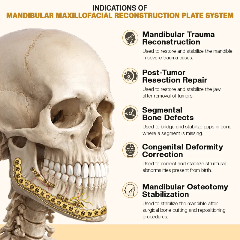 Key Indications of 2.4mm Mandibular Maxillofacial Reconstruction Plate System