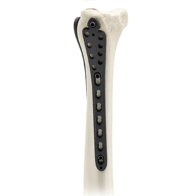Locking Distal Tibia Plate with bone
